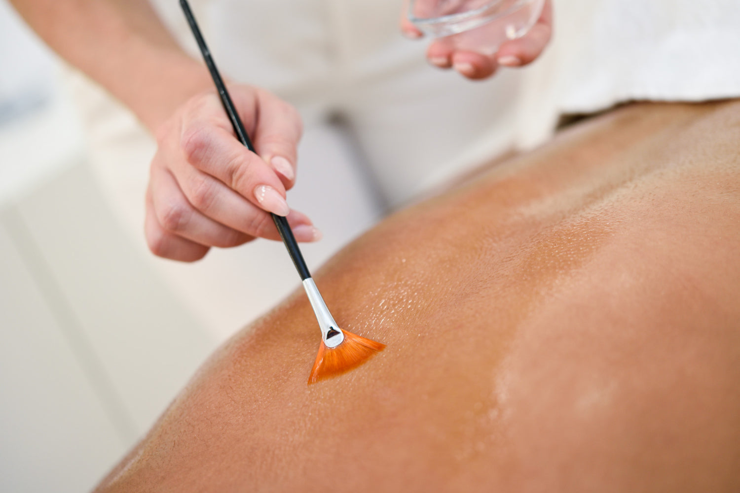PCA Body Peel